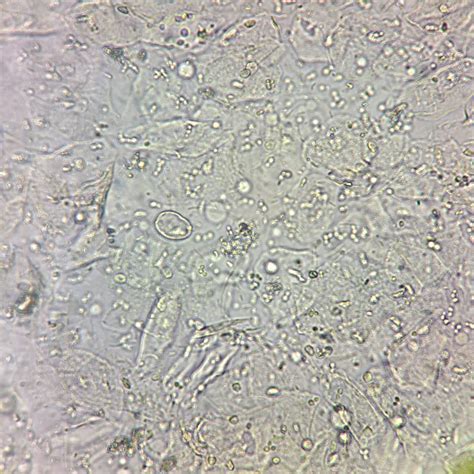 Image result for Transitional Epithelial Cells