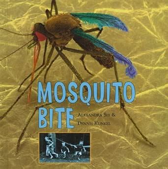 Mosquito Bite : Siy, Alexandra: Amazon.in: Books