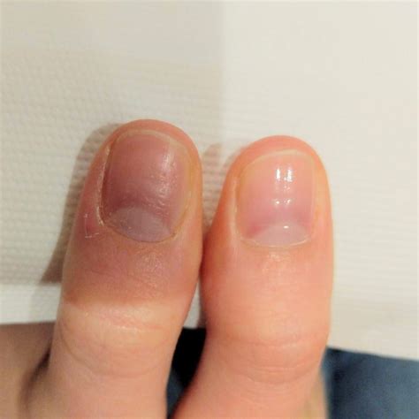 Bumpy Nails 的图像结果