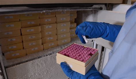 Image result for Tissue Sample Test