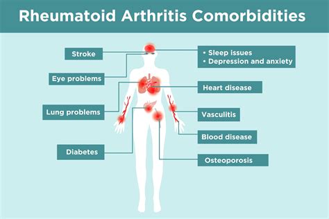 Rheumatoid Arthritis Community: Support, Resources, and Discussion