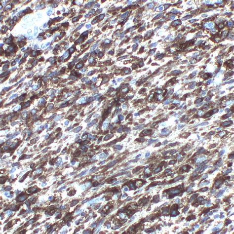 CD117(c-kit)-Polyclonal | Pathnsitu Biotechnologies
