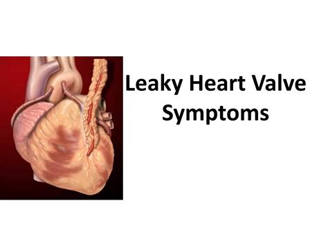 What Vitamins Are Good For A Leaky Heart Valve at Susan Pittman blog