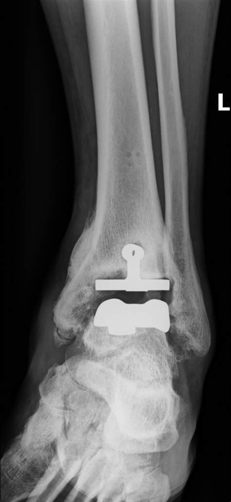 Hardware Monitor Driver 的图像结果