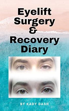 Eyelift Surgery and Recovery Diary: Ptosis, eyelifts, punctal plugs ...