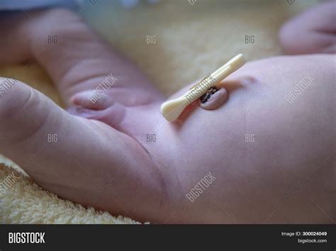 Baby's Belly Button When Cord Falls Off at JENENGE blog