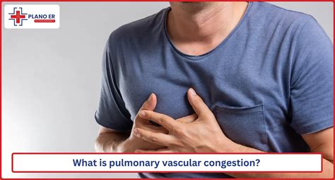 An overview of pulmonary vascular congestion