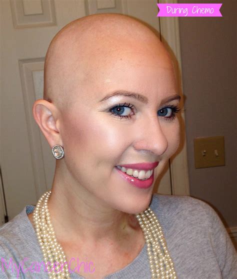 How To Improve Hair Growth After Chemo at Erminia Heavner blog