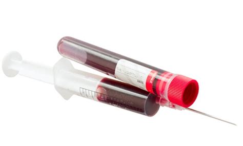 What Do You Need to Know About Thyroid Blood Tests? | Newsmax.com