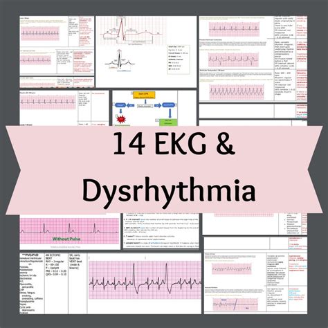 Image result for EKG Algorithm