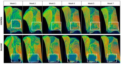 Evaluation of a Granular Bone Substitute for Bone Regeneration Using an ...