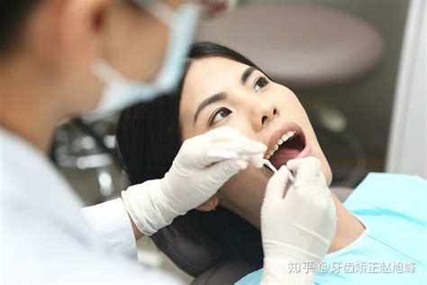 牙医拔牙 为什么牙医总建议拔牙_华夏智能网