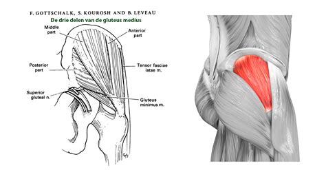 Knots In Gluteus Medius at Jackson Steinfeld blog