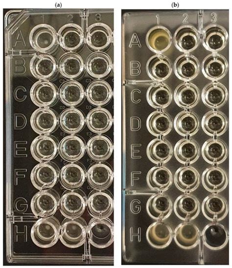 Antibiotics | Special Issue : Antibiotic Therapy against Bacterial ...