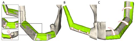 A User-Friendly Software for Automated Knowledge-Based Virtual Surgical ...