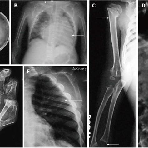 Image result for Graphical Abstract Examples of a Process