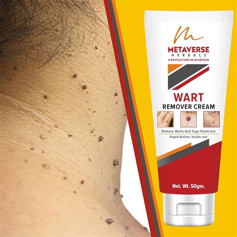 Buy Metaverse Wart Remover Ointment For Men & Women Wart Removal Cream ...