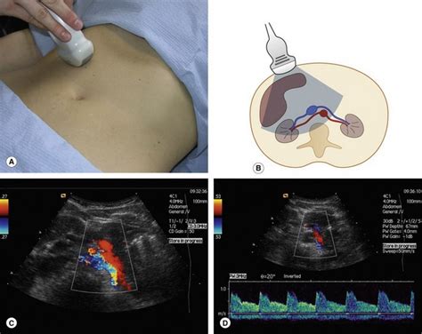 Image result for Ultrasound Lab