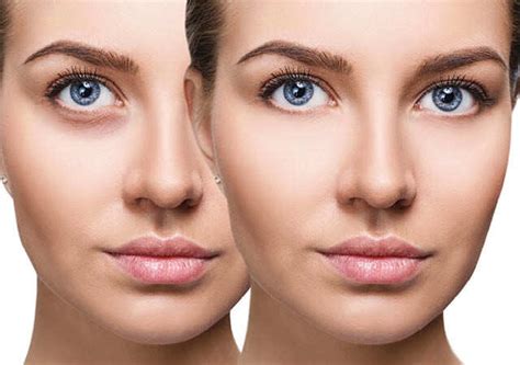 DIY Cucumber Face Mask At Home: Benefits | Femina.in