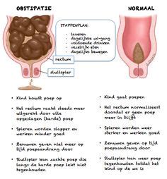 Impacted Bowel