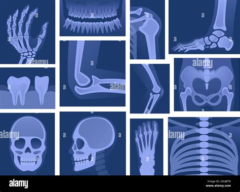 Image result for Body Parts Scan