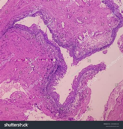 Skenes Glands Diagram