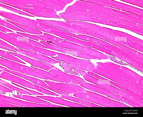 Image result for Skeletal Muscle Tissue Function