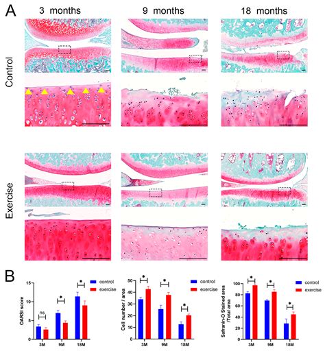 Effect of Moderate Exercise on the Superficial Zone of Articular ...