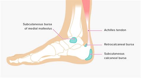 Bursitis: Ankle Bursa, Care, and Prevention