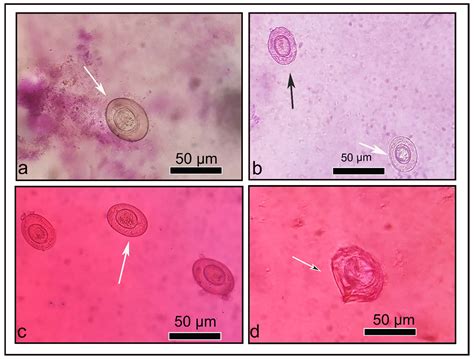Tunable Polymeric Mixed Micellar Nanoassemblies of Lutrol F127/Gelucire ...