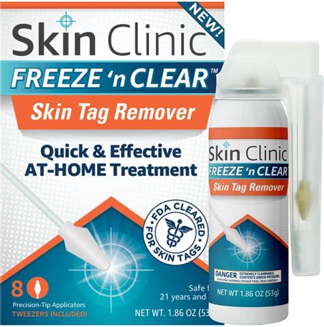 Freezing Skin Tags