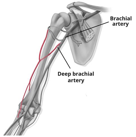 Radial Artery