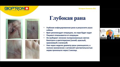 ЗАЖИВЛЕНИЕ РАН. ЛЕЧЕНИЕ БОЛИ. ИСТОРИИ БОЛЕЗНИ. on Vimeo