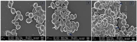 Antifungal Activity of Human Cathelicidin LL-37, a Membrane Disrupting ...