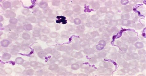Role Of T Cells In Fat & Muscle Loss During Infection [1 min read]