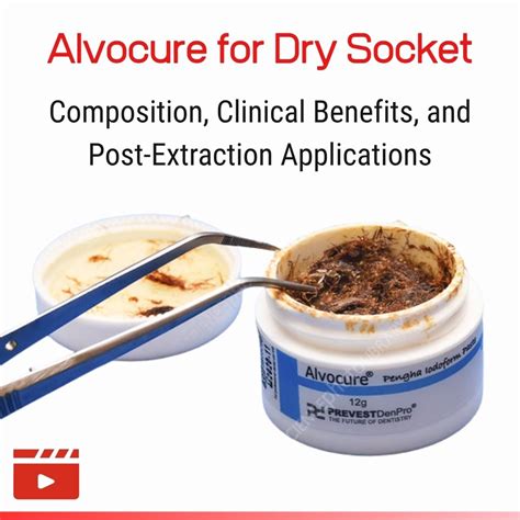 VIDEO: Alvocure for Dry Socket: Composition, Clinical Benefits, and Post-Extraction Applications