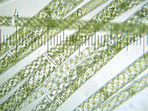 Spirogyra Microscope