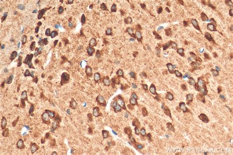 GDNF antibody (26179-1-AP) | Proteintech
