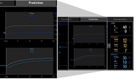 WATO EX-65 Pro - Anesthesia Machine - Mindray India