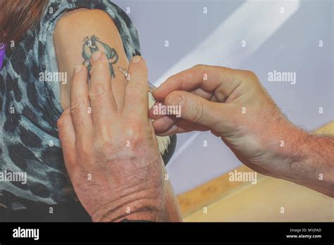 Arm Injection 的图像结果