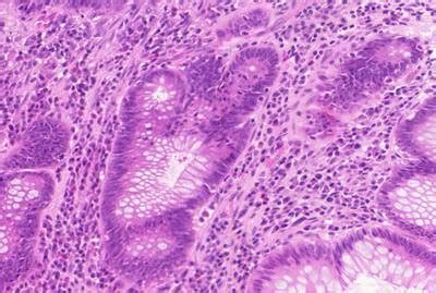 GlaS@MICCAI'2015: Gland Segmentation - Dataset Ninja