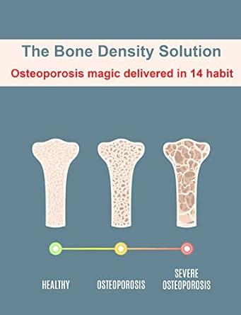 The Bone Density Solution: Osteoporosis magic delivered in 14 habit ...
