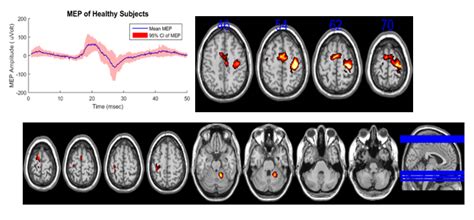Research | Centre for Biomedical Engineering
