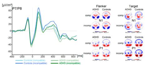 Intact Stimulus–Response Conflict Processing in ADHD—Multilevel ...