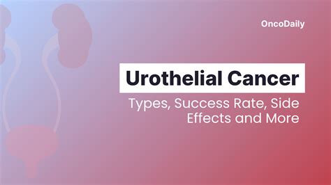 Immunotherapy for Urothelial Cancer: Types, Success Rate, Side Effects and More - OncoDaily