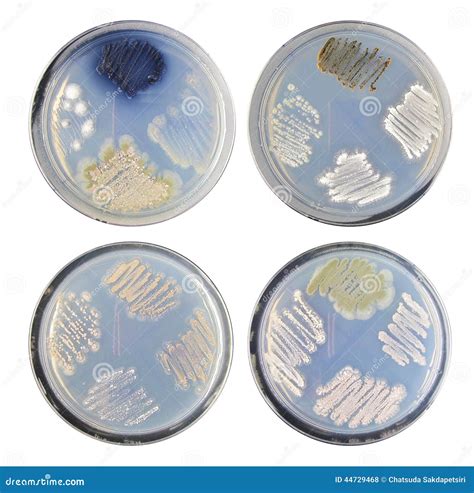 Set of Varity Colony Bacteria (actinomycetes) Morphology on Agar Stock ...