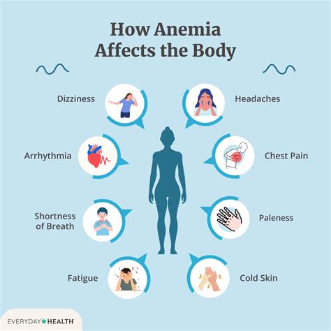 12 Most Common Iron-Deficiency Anemia Symptoms