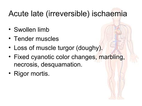 Acute limb ischemia | PPT