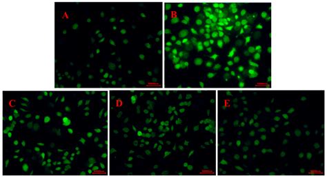 Preparation of Antioxidant Peptide by Microwave- Assisted Hydrolysis of ...