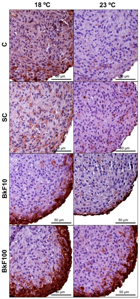 Effects of Benzo[k]fluoranthene at Two Temperatures on Viability ...